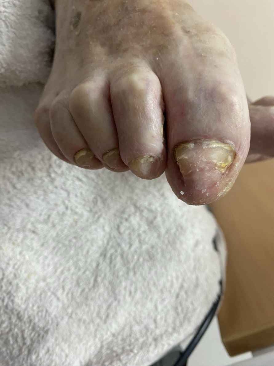 Многие белорусы неправильно покупают носки и обувь? Подолог рассказала, какими проблемами стоп это грозит