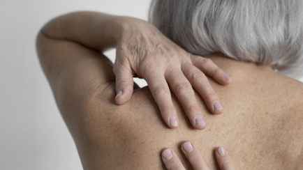 Эта привычка во время сна может спровоцировать «вдовий горб». Физиотерапевт объяснила, что делать