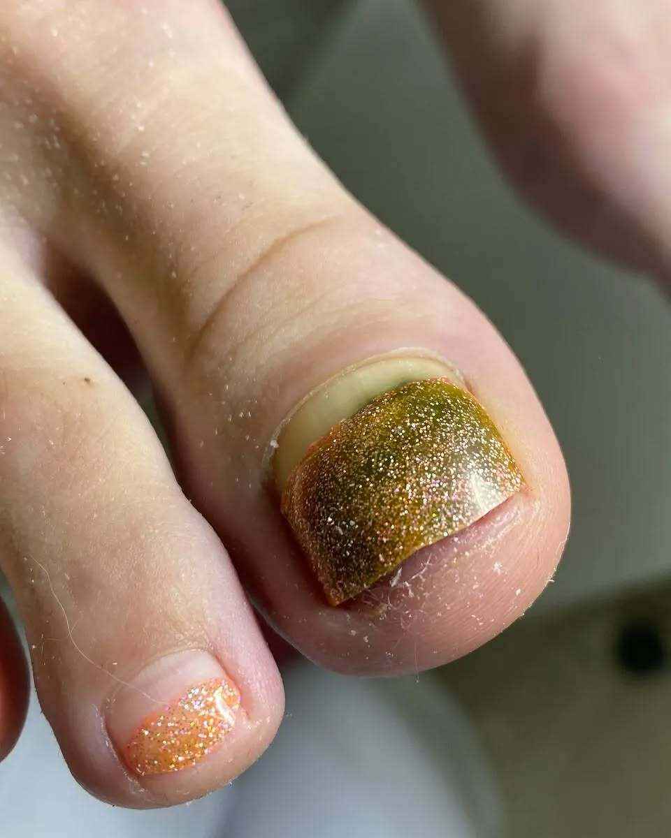 Изменение цвета ногтевой пластины под гель-лаком, фото: Татьяны Стасюкевич