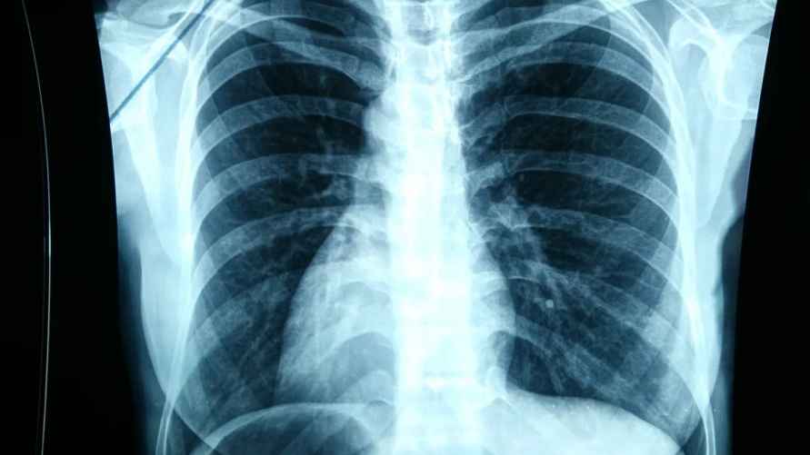 Фото иллюстрационное