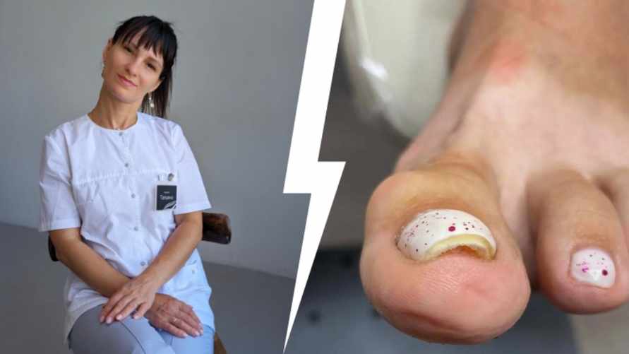 Почему весной и летом гель-лак на ногах может быть опасен? Подолог показала "печальные последствия"