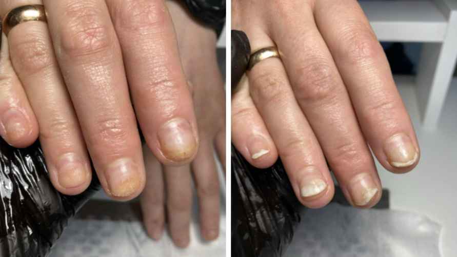 Ногти после покрытия гель-лаком, фото: Татьяны Стасюкевич