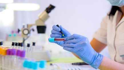 Минздрав Беларуси утвердил новые максимальные тарифы на платные лабораторные анализы