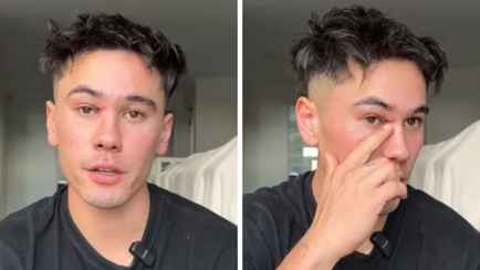 Мужчина рассказал, почему перенес две операции из-за «крошечного прыщика»