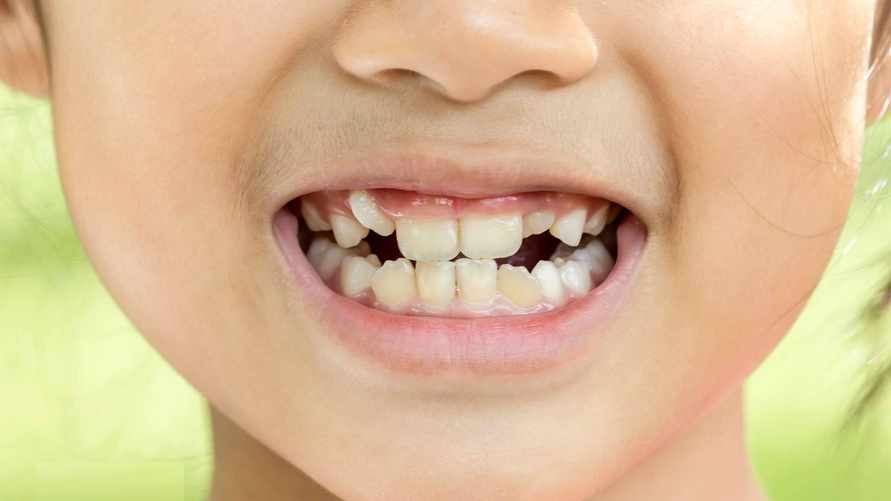 Фото иллюстрационное