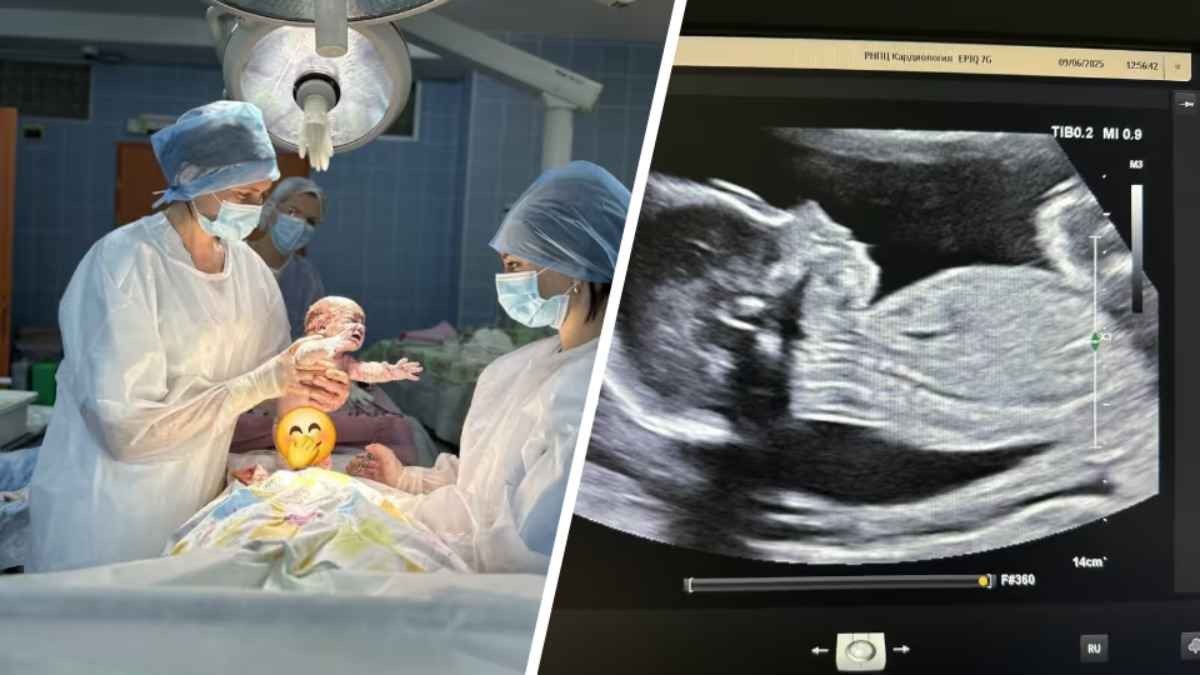 Белорусские кардиохирурги впервые успешно удалили опухоль ещё не родившемуся малышу