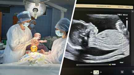Белорусские кардиохирурги впервые успешно удалили опухоль ещё не родившемуся малышу