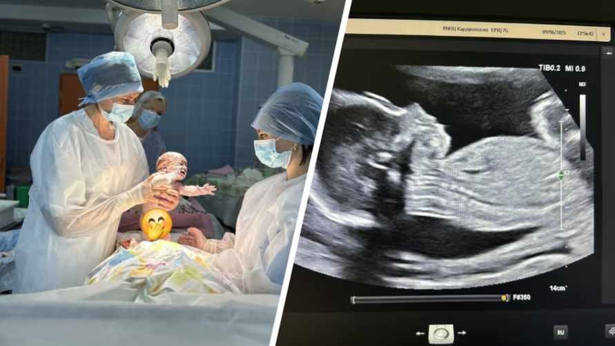 Белорусские кардиохирурги впервые успешно удалили опухоль ещё не родившемуся малышу