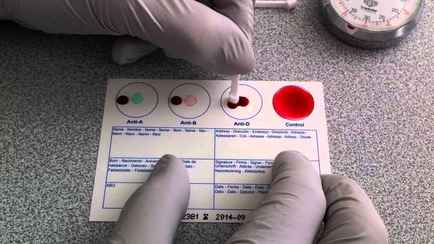 Минздрав объяснил, кому из белорусов будут ставить группу крови в паспорте. А кому никогда?