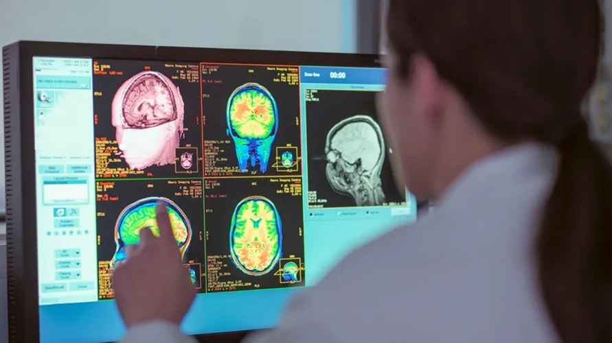 Учёные сместили подростковый возраст. Когда мозг «взрослеет» на самом деле?