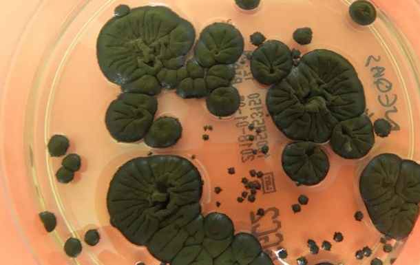 NASA заинтересовалось чернобыльскими грибами для защиты астронавтов от космической радиации