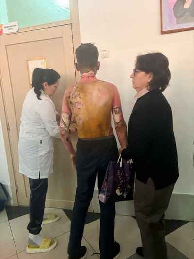 В России школьница облила одноклассников бензином и подожгла прямо в школе